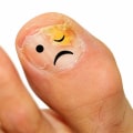 What is the danger of not treating toenail fungus?