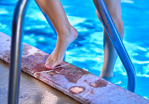 Can i go to pool with foot fungus?